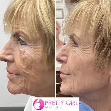 Pretty Girl Aesthetics