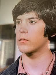 I'm sitting here watching the episode Family Tree where Albert finally and  legally gets adopted. Looks like the makeup people tried to cover up a  busted chin. In HD you can definitely