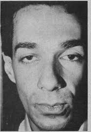 Direct Approach in Management of Severe