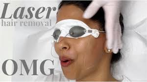 What to expect during a session. I Did Laser Hair Removal All Over My Face Youtube