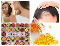 A well balanced diet will help you maintain overall health. Which Vitamin Deficiency Causes Hair Loss Hair Treatment Clinic Lahore