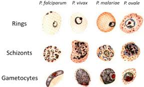 Microscopic Tests Malaria Site