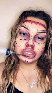 Creating faces from lips after skin surgery experience