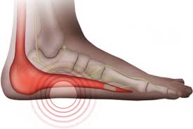 Image result for Foot Pain