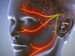 как лечить воспаление тройничного лицевого нерва в домашних условиях Domashnee Lechenie Trojnichnogo Nerva I Narodnye Sredstva