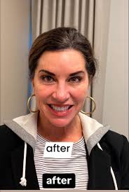 Runnels & North Plastic Surgery • SKIN the Spa