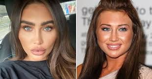 Woman bullied for looking like squirrel has stomach…