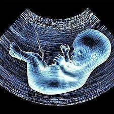 Penebalan dinding rahim (hiperplasia endometrium) adalah lapisan dinding rahim yang terus bertambah karena kenali hiperplasia endometrium, penebalan dinding rahim yang tidak normal. Gejala Penebalan Dinding Rahim Atau Solusi Hamil Cepat Facebook