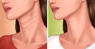 What are the best exercises for neck skin? 6 Tips To Make Your Neck Lines Go Away