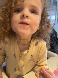 Ashley is off the ventilator, they have removed it from her room 😃😃😃 She  still has the trach because that's what gives her oxygen ❤️❤️❤️