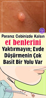 cilt bakimi panosundaki pin