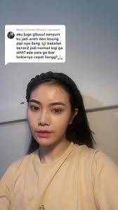 Replying to @karen hillary sabar ya kak pasti ilang kok biasanya 6 bul...