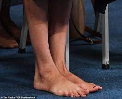 How Meghan S Love Of Heels Has Left Her With A Bunion Meghan Markle Pics Princess Meghan Bunion