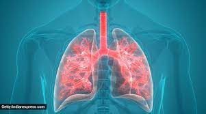 The global burden of disease study reports a prevalence of 251 million cases of copd globally in 2016. World Copd Day Here S Everything You Need To Know About The Chronic Lung Disease Lifestyle News The Indian Express