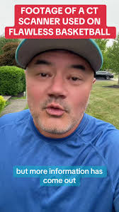 Ct Scanner Flawless Cards