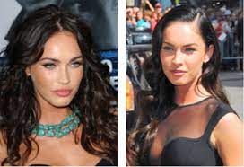 Hair loss can be caused by a wide range of things such as stress, ageing, hormonal imbalances, medication, and medical conditions such as thyroid in most cases, hair loss is often temporary and simple changes such as living a healthy lifestyle and changes in medication can help to solve this but. Celebrity Hair Loss Jr Hair Solutions