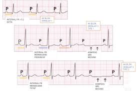 Maybe you would like to learn more about one of these? Soal Kardiologi Medicalstudentnotes