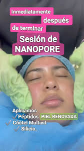 📲 Dermatóloga, Dra.Sonia Calles Batres , ♦️ C I T A S :, 📲 22 26 66 53 ,  📲 70 85 28 91 , ( WhatsApp )., ♦️ Santa Elena , Zona Embajada de U.S.A  Antiguo Cuscatlán .