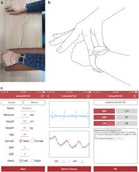 We did not find results for: Validation Of A Wearable Cuff Less Wristwatch Type Blood Pressure Monitoring Device Scientific Reports