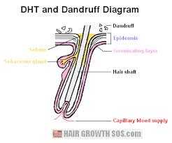 So, does shampoo simply keep hair clean? Does Dandruff Cause Hair Loss