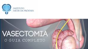 A vasectomy is a small operation a man has to prevent pregnancy. Vasectomia Pode Falhar Como E A Cirurgia O Que E Preciso Saber Antes O Guia Completo Youtube