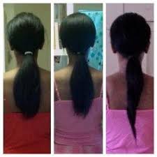 Biotin Hair Growth Results Before And After Biotin Hair Growth Reviews Biotin Hair Growth Before And After Pictures Monistat Hair Growth Biotin Hair Growth Hair Growth Challenge