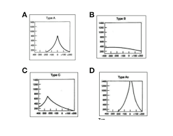 Image result for Tympanometry