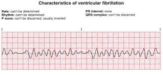 Pin On Heart Stuff