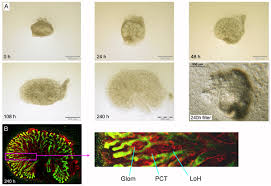 Check spelling or type a new query. A Novel Low Volume Method For Organ Culture Of Embryonic Kidneys That Allows Development Of Cortico Medullary Anatomical Organization