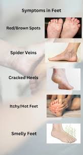 Image result for brown patches on the feet