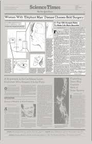 We did not find results for: Woman With Elephant Man Disease Chooses Bold Surgery The New York Times
