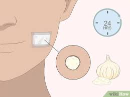 So these are the top six and best home remedies for one to try to remove mole from their skin, now you need not worry for using any artificial. 3 Ways To Remove Moles Quickly Wikihow