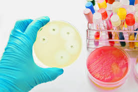 It is also used to isolate and maintain neisseria and moraxella species. Antimicrobial Testing With Mueller Hinton Agar