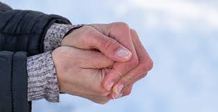 Image result for Frostbite