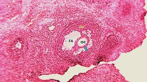 Image result for Phyllanthus muellerianus