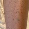 The world's oldest documented case of cancer hails from ancient egypt more cancer signs and symptoms. 3