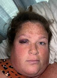 Fundraiser by Amy Lothridge : Living in Constant Pain .