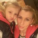 Syndaktýlia a jej liečba