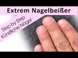 Eine tiefgreifende störung steckt in den seltensten fällen dahinter. Nagelbeisser Extrem Nagelmodellage Step By Step Youtube