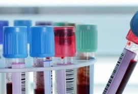 Cu biletul de la medicul de familie si biletul de la medicul ginecolog, merge la un laborator care lucreaza cu casa de asigurari (medcenter de ex ; Oferte Analize De Laborator Eurosanity