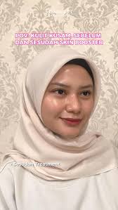 Checklist treatment brightening😍✨ Favorit kamu yang mana nih, Sahabat  Scarlett🫰🏻 Your Skin Journey Start Here! Informasi lebih lanjut hubungi :  📲 081904863000 (WhatsApp Admin Online)