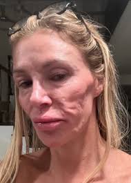 Hannah Louise Poston Has Lost the Plot on Aging...Right After Finding It :  rBeautyGuruChatter