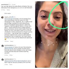 Is Organic Olivia really an herbalist? And why won't she admit her eyebrow  Botox lift : r/NYCinfluencersnark
