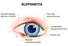 Image result for Blepharis transvaalensis