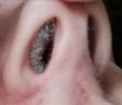 That means only few beard hairs i am just 30 years old i am having white hair on my mustache and beard and some in nose hair how. I Was Spray Painting My 40k Army And Sneezed I Noticed My Nose Hairs Hasd Been Dyed White After 2 Hours It Dried Mildyinfuriating