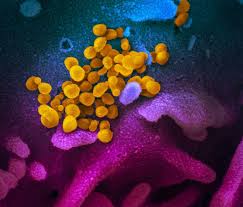 New coronavirus stable for hours on surfaces | National Institutes ...