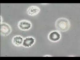 In a living system, though, energy when swimming, our blood system is protected from water by our skin. Red Blood Cells In A Hypertonic Solution Youtube
