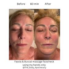New 60 min offerings under Face/Head/TMJD focused section of my menu. This  is an example of one appointment before/after using fascia massage &  Buccal/Intraoral massage to improve circulation, relax adhesions that can