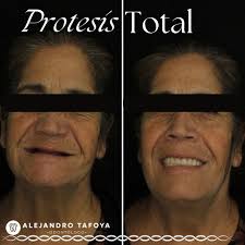 Dr. Alejandro Tafoya (@dr.alejandrotafoya) • Instagram photos and videos