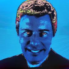 What device gives the best image quality for LZX rig via component at  1080i60?